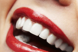 Tratamiento arte y estetica dental