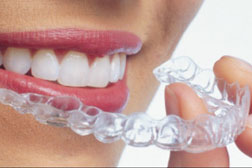 Tratamiento dental invisaling